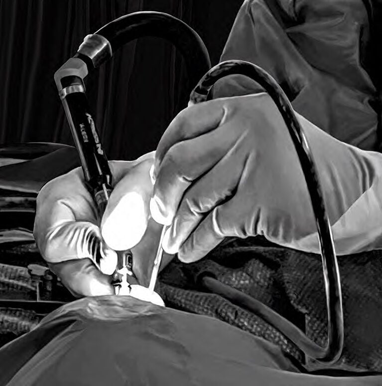 Anterior Approach